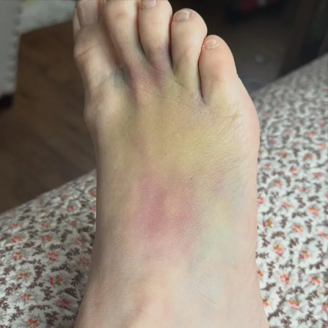 Amanda Seyfried showing a bare foot resting on patterned fabric.