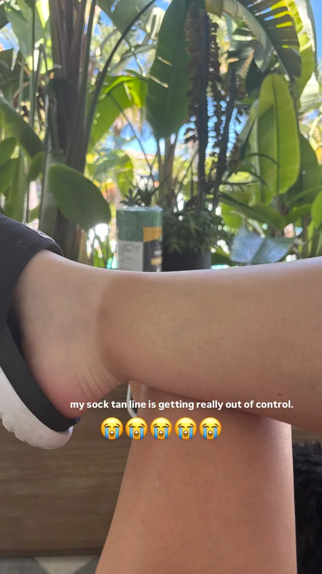Iggy Azalea showing a sock above her ankle in an outdoor photograph.