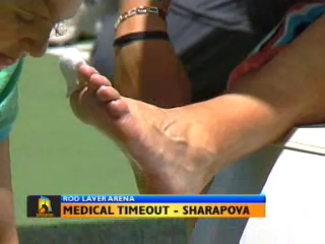 Maria Sharapova receiving treatment to her bare foot during a tennis medical timeout.