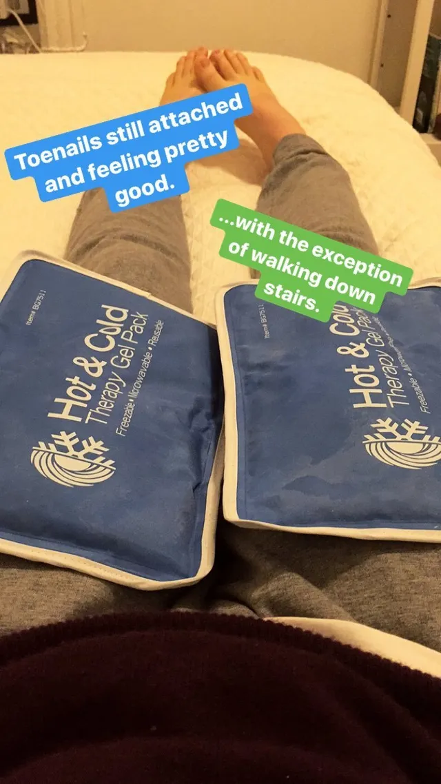 Willa Fitzgerald resting a bandaged bare foot on a couch.
